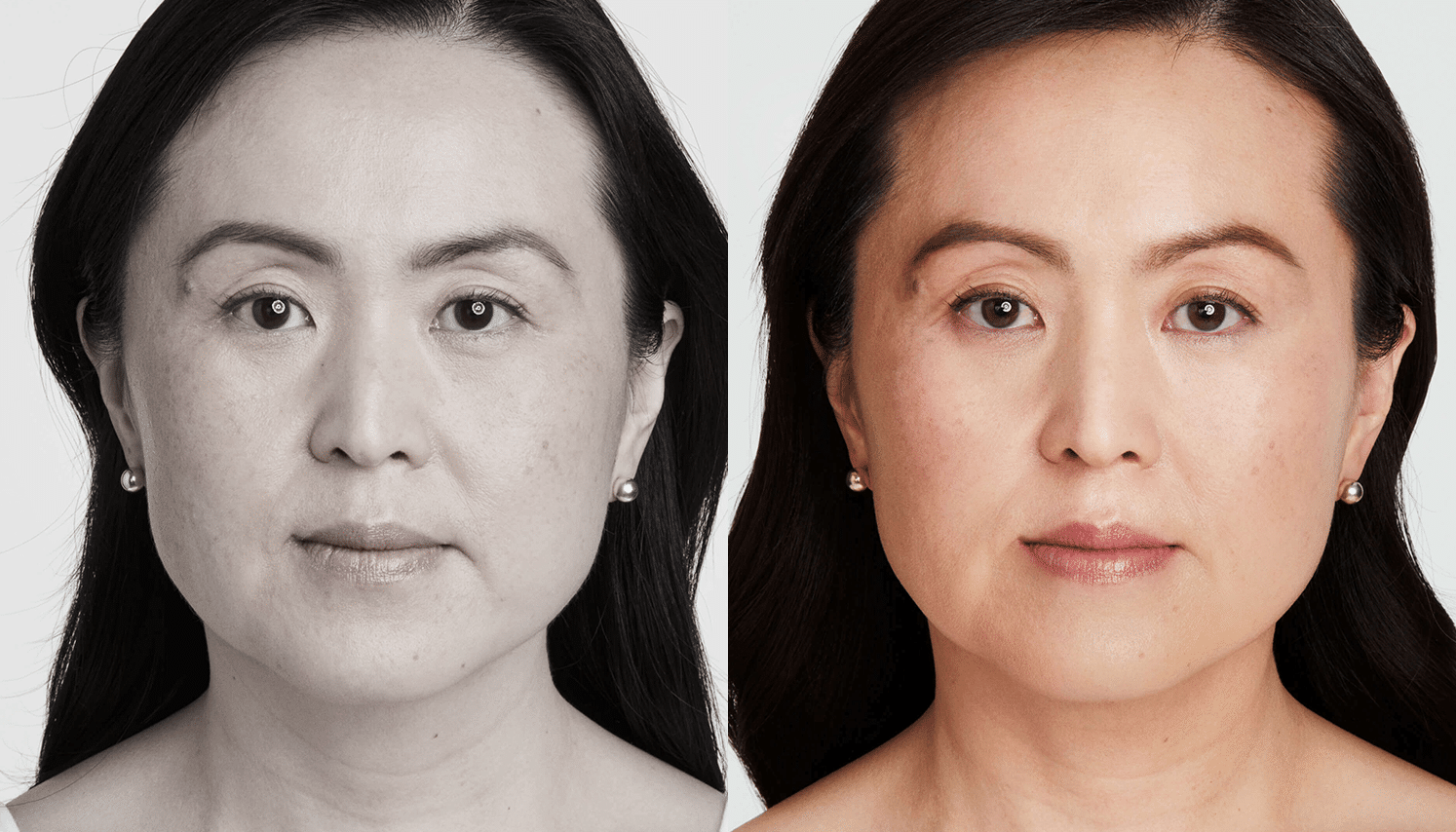 Ultrassom Estético e Microfocado - Salvador 8 Ultrassom-2