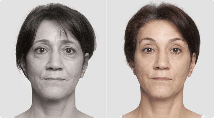 Fios-de-sustentacao-3