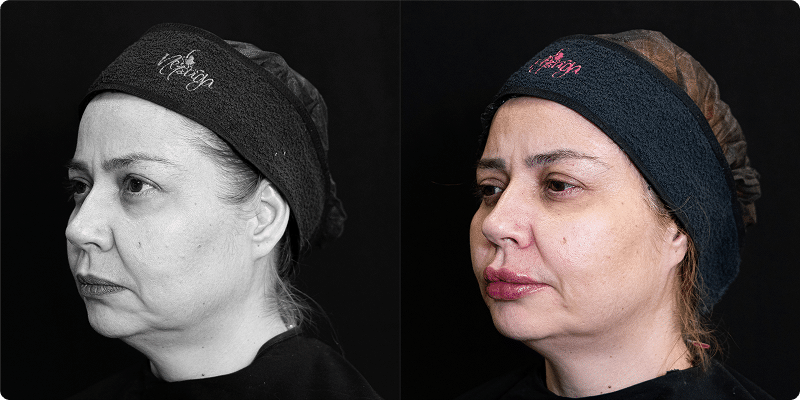 imagem-antes-e-depois 1