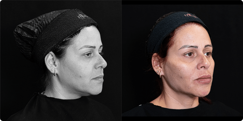 imagem-antes-e-depois-2 1