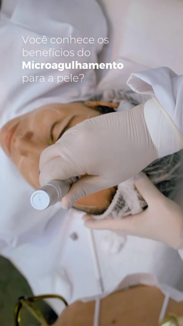 Você sabia que o microagulhamento estimula a produção natural de colágeno e elastina? O resultado é uma pele mais firme, uniforme e com aquele glow saudável que a gente ama! 💆‍♀️💖

Agulhinhas que transformam a sua pele de dentro pra fora! ✨
#Microagulhamento #PeleBonita #Colágeno #EstéticaAvançada #BelezaReal