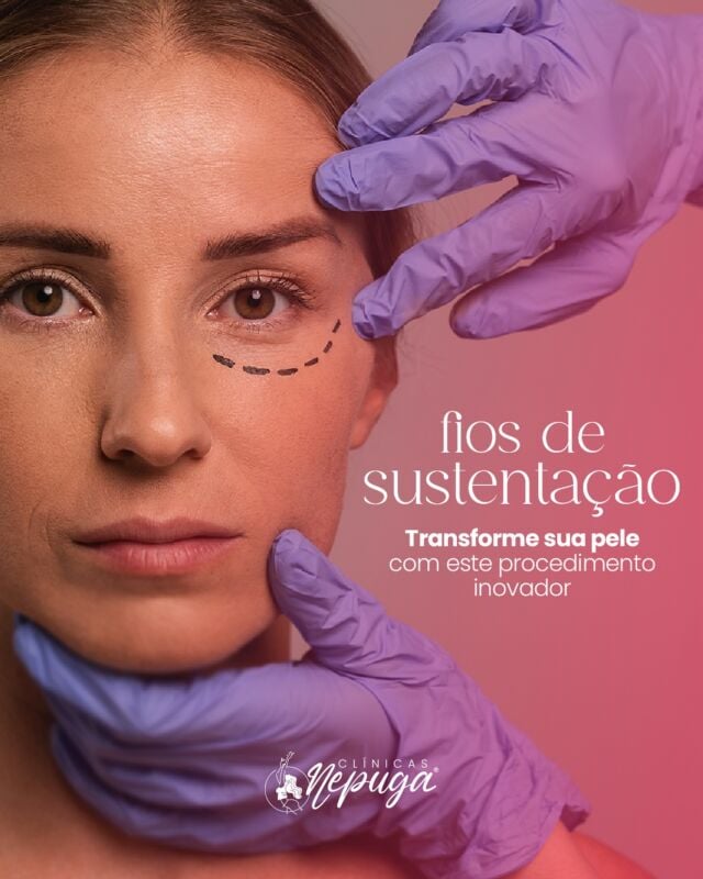 Quer um efeito lifting sem cirurgia? Os fios de sustentação estimulam o colágeno, redefinem contornos e devolvem firmeza à pele de forma natural e segura.

Resultados visíveis, autoestima renovada.
Agende sua avaliação e descubra a melhor versão de você! 💖

#FiosDeSustentação #PeleFirme #EstéticaAvançada #ClinicasNepuga #BelezaNatural