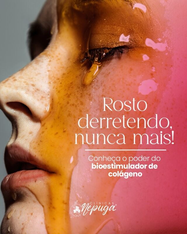 Dê tchau ao rosto derretido! 🫠

Com o poder do bioestimulador de colágeno, nós trazemos a solução para um rejuvenescimento facial sem igual.

Este tratamento não apenas
restaura a firmeza e elasticidade da pele, mas também estimula a produção natural de colágeno, resultando em um visual naturalmente jovem e radiante.

Quer saber mais? Entre em contato com a nossa equipe!