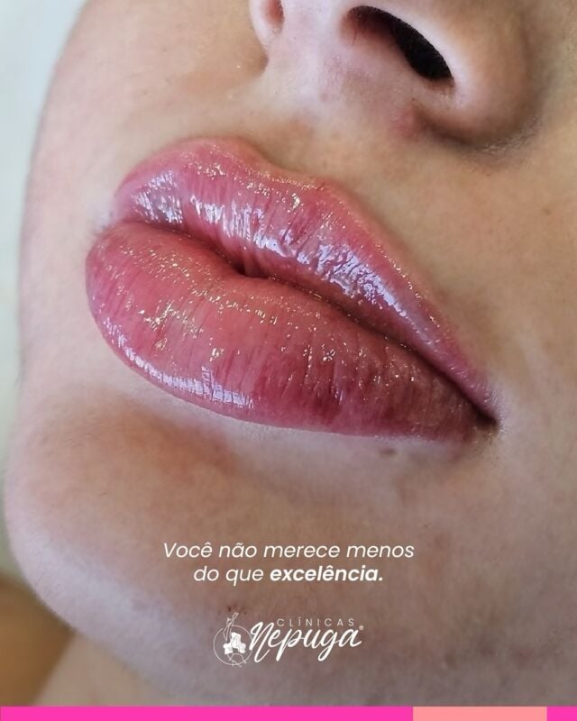 Por trás de cada resultado que você vê, existe um processo que começa muito antes da aplicação.

Aqui, cada protocolo é cuidadosamente planejado, respeitando sua individualidade, suas necessidades e o que faz sentido para a sua beleza real.

✨ Executamos com técnica, experiência e responsabilidade. Porque mais do que mudar rostos, queremos transformar percepções.

Mais do que resultados estéticos, buscamos autoestima fortalecida.