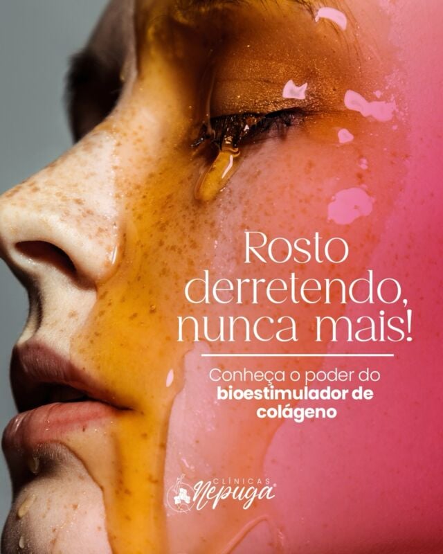 Dê tchau ao rosto derretido! 🫠

Com o poder do bioestimulador de colágeno, nós trazemos a solução para um rejuvenescimento facial sem igual.

Este tratamento não apenas
restaura a firmeza e elasticidade da pele, mas também estimula a produção natural de colágeno, resultando em um visual naturalmente jovem e radiante.

Quer saber mais? Entre em contato com a nossa equipe!