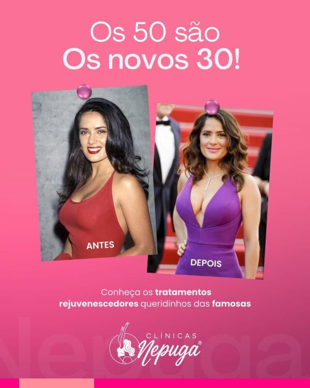 👑 ELA TEM 58… E DÁ UM SHOW NAS DE 20! 👑
Salma Hayek é a prova viva de que a beleza não tem idade — tem atitude, cuidado e escolha certa. E você, já se olhou no espelho hoje e se imaginou poderosa como ela?

✨ A beleza madura é um privilégio de quem se cuida com inteligência.
Na Clínica Nepuga®️, oferecemos procedimentos de harmonização facial e rejuvenescimento que respeitam sua essência e realçam o que há de mais bonito em você — com naturalidade e sofisticação.

💎 Tecnologia exclusiva PugaCode®️, aprovada pela Anvisa, com resultados seguros, duradouros e naturais.
Aqui, você é atendida por profissionais treinados com o mais alto padrão da estética médica nacional.

📍 Para mulheres que querem se sentir tão radiantes quanto parecem.

🔥 Porque idade não te limita. Quem dita as regras agora é você.

📲 Agende sua avaliação na unidade de Goiânia pelo WhatsApp.
Vagas limitadas — transforme-se com quem é referência!

#goiânia #goiania #gyn #goianiashopping