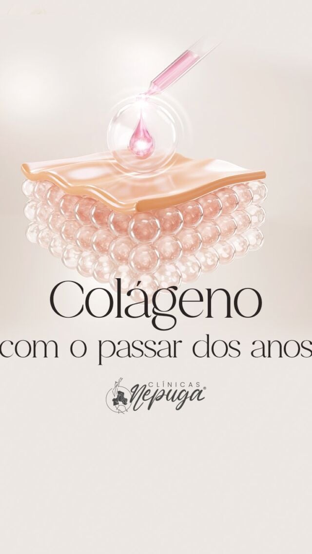 Essa é a sua quantidade de colágeno ao longo do tempo... O que você perde com o passar dos anos, o bioestimulador devolve! 💉

Recupere a firmeza, o viço e a jovialidade da sua pele com um tratamento que estimula seu corpo a produzir mais colágeno naturalmente!

⏳ O tempo pode levar, mas a tecnologia traz de volta!

#BioestimuladorDeColágeno #PeleRenovada #TratamentoAntienvelhecimento #BelezaNatural #Rejuvenescimento