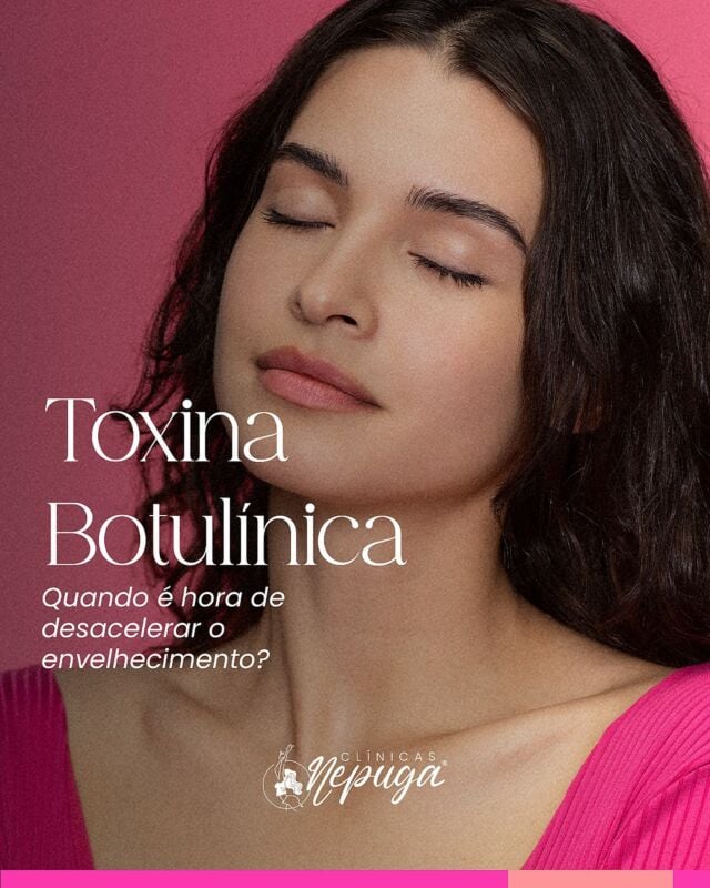 Rio de janeiro - RJ | Nepuga Unidades 19 Toxina Botulínica Preventiva: Quando começar?
A aplicação preventiva da toxina botulínica ajuda a suavizar a ação muscular antes que as rugas se tornem marcas permanentes. É indicada a partir dos primeiros sinais de expressão repetitiva — como linhas na testa, entre as sobrancelhas ou ao redor dos olhos.
Com leveza e naturalidade, o protocolo preserva a harmonia facial e desacelera o envelhecimento visível.
📍 Agende uma avaliação e descubra se esse é o momento certo para você.
#EstéticaConsciente #BotoxPreventivo #HarmonizaçãoNatural