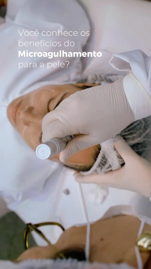 Rio de janeiro - RJ | Nepuga Unidades 21 Você sabia que o microagulhamento estimula a produção natural de colágeno e elastina? O resultado é uma pele mais firme, uniforme e com aquele glow saudável que a gente ama! 💆♀️💖
Agulhinhas que transformam a sua pele de dentro pra fora! ✨
#Microagulhamento #PeleBonita #Colágeno #EstéticaAvançada #BelezaReal