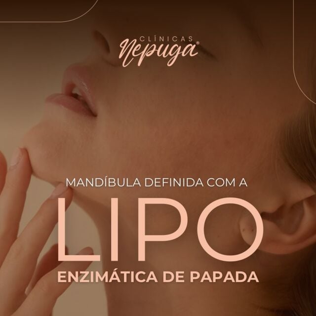 👉 Cansada de se olhar no espelho e se incomodar com aquela gordurinha teimosa na papada? A Lipo Enzimática de Papada chegou para te ajudar a conquistar o contorno facial que você sempre sonhou!

Imagine... se olhar no espelho e finalmente se sentir linda e confiante com o seu rosto. Sem filtros, sem ângulos estratégicos, apenas você e a sua beleza natural.

🙌 Com a Lipo Enzimática de Papada, isso é possível! Através de um procedimento rápido, eficaz e seguro, eliminamos a papada e definimos o contorno do seu rosto, te dando a autoestima que você merece.

Veja como a Lipo Enzimática de Papada pode transformar a sua vida:

✨ Resultados rápidos e visíveis: Diga adeus à papada em poucas sessões;

✨ Procedimento não invasivo: Sem cortes, sem necessidade de internação e com recuperação rápida;

✨ Autoestima renovada: Sinta-se mais confiante e feliz com a sua aparência;

✨ Beleza natural: Realce a sua beleza natural sem precisar de filtros ou artificios;
Chega de se esconder!

👉 Agende sua avaliação gratuita e descubra como a Lipo Enzimática de Papada pode te ajudar a conquistar o rosto que você sempre quis.

#clinicasnepuga #nepuga #draanacarolinapuga #lipodepapada #lipoenzimatica #estetica #esteticafacial #beauty