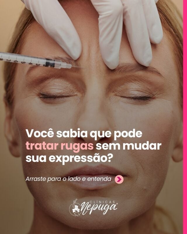 ✨ Sim, dá pra suavizar rugas sem perder sua naturalidade!

Se você tem medo do “rosto congelado”, precisa conhecer o protocolo exclusivo PugaCode®️ das Clínicas Nepuga. Técnica precisa, segura e personalizada, feita por profissionais capacitados, com resultados naturais e expressões preservadas.

👉 Deslize e entenda como a toxina botulínica pode realçar sua melhor versão.
📲 Agende sua avaliação!

#BotoxNatural #ClínicaNepuga #PugaCode #EstéticaSegura #SuaMelhorVersão #HarmonizaçãoFacial