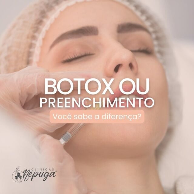 ✨A principal substância aplicada no preenchimento é o ácido hialurônico, que promove o aumento do volume de determinadas regiões do rosto. 

✨A toxina, por sua vez, tem função preventiva, evitando vincos, rugas e linhas de expressão que podem surgir devido ao processo de envelhecimento natural da pele.