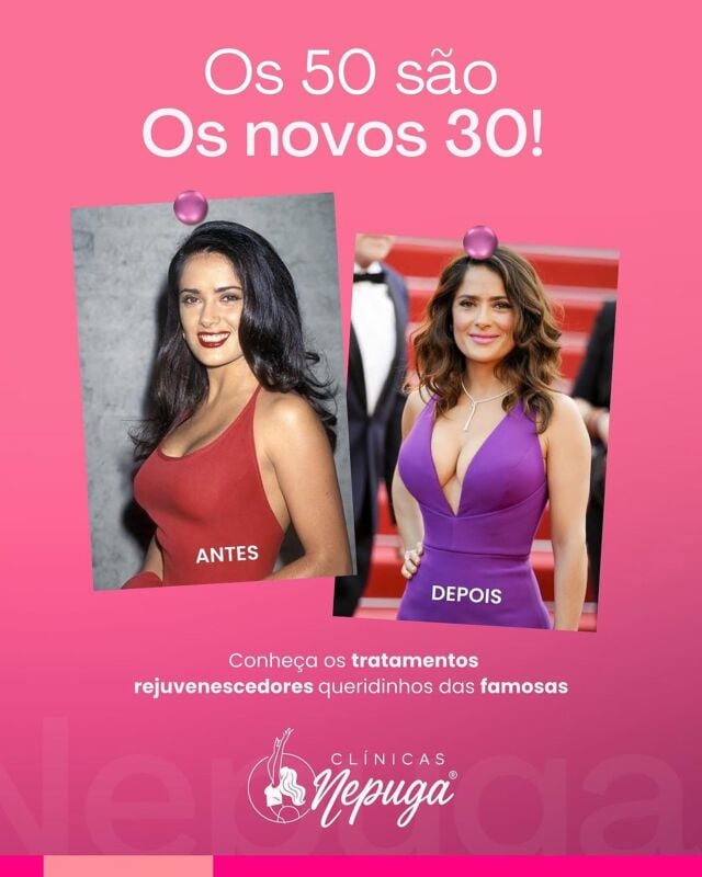 👑 ELA TEM 58… E DÁ UM SHOW NAS DE 20! 👑
Salma Hayek é a prova viva de que a beleza não tem idade — tem atitude, cuidado e escolha certa. E você, já se olhou no espelho hoje e se imaginou poderosa como ela?

✨ A beleza madura é um privilégio de quem se cuida com inteligência.
Na Clínica Nepuga®️, oferecemos procedimentos de harmonização facial e rejuvenescimento que respeitam sua essência e realçam o que há de mais bonito em você — com naturalidade e sofisticação.

💎 Tecnologia exclusiva PugaCode®️, aprovada pela Anvisa, com resultados seguros, duradouros e naturais.
Aqui, você é atendida por profissionais treinados com o mais alto padrão da estética médica nacional.

📍 Para mulheres que querem se sentir tão radiantes quanto parecem.

🔥 Porque idade não te limita. Quem dita as regras agora é você.

📲 Agende sua avaliação na unidade de São Paulo pelo WhatsApp: 1191031-1435
Vagas limitadas — transforme-se com quem é referência!

#saopaulo #sp #itaim #moema #mooca #tatuape #analiafranco