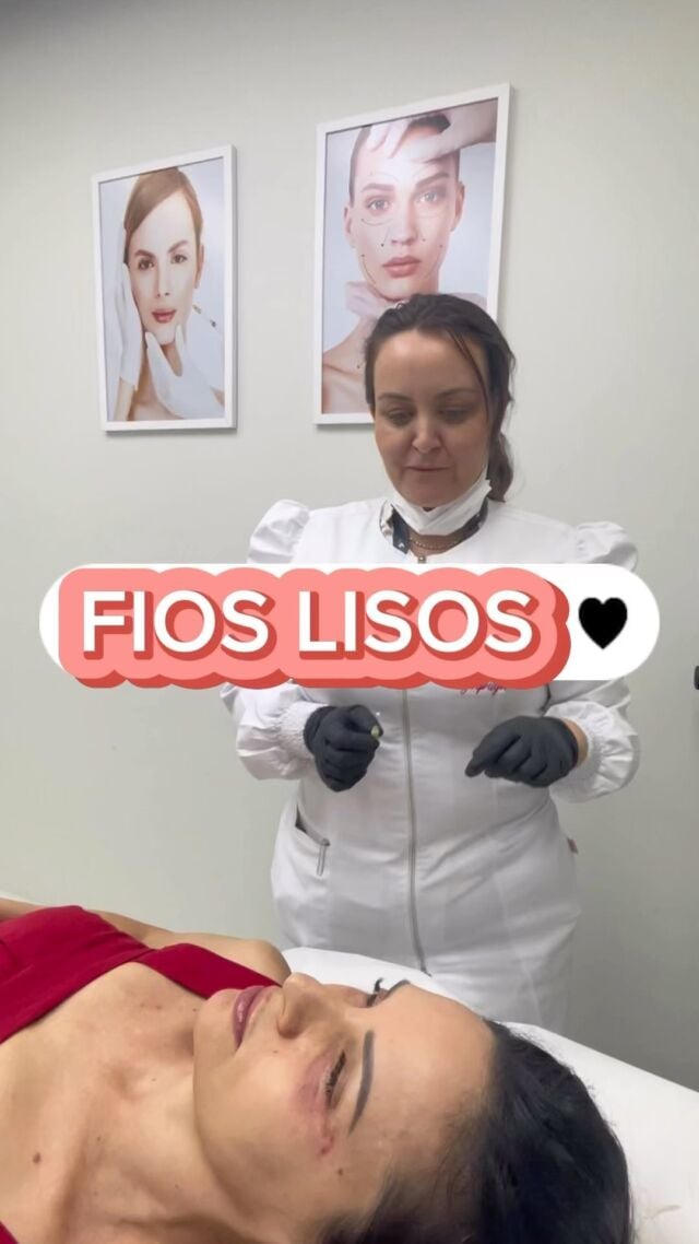 👉🏻Fios Lisos, para que servem e por que tem sido procurados cada vez mais na estética?

❤️Um procedimento super tranquilo, realizado em pouquíssimo tempo e com ótima durabilidade.

✨Usados para melhora da flacidez e da qualidade da pele, combate as indesejadas rugas finas que denotam envelhecimento.
sua principal função é melhorar a qualidade da pele através do seu alto poder de estímulo à produção de colágeno.

🥰Paciente realizou a colocação de 8 Fios Lisos após a recomendação da @dra.marjoridellarovere, cada paciente tem uma necessidade diferente. Lembrando que o cuidado pós procedimento para duração dos fios é indispensável.

#fioslisos #fioslisospdo #fiosdecolageno #biomedicinaestética #enfermagemestetica #biomedicina #estetica #beleza #belezafeminina #belezaesaúde #draanacarolinapuga