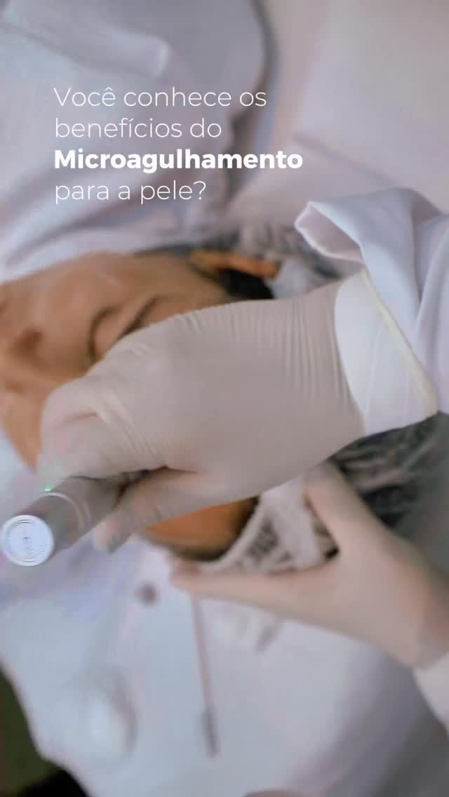 Você sabia que o microagulhamento estimula a produção natural de colágeno e elastina? O resultado é uma pele mais firme, uniforme e com aquele glow saudável que a gente ama! 💆‍♀️💖

Agulhinhas que transformam a sua pele de dentro pra fora! ✨
#Microagulhamento #PeleBonita #Colágeno #EstéticaAvançada #BelezaReal