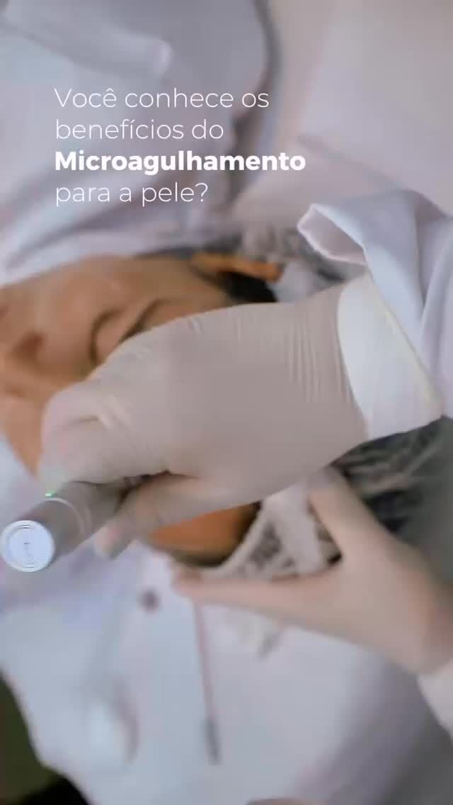 Salvador - BA | Nepuga Unidades 21 Você sabia que o microagulhamento estimula a produção natural de colágeno e elastina? O resultado é uma pele mais firme, uniforme e com aquele glow saudável que a gente ama! 💆♀️💖
Agulhinhas que transformam a sua pele de dentro pra fora! ✨
#Microagulhamento #PeleBonita #Colágeno #EstéticaAvançada #BelezaReal